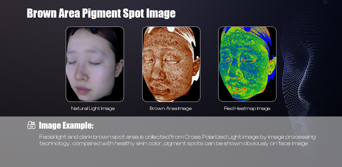 3D skin analysis machine (6).jpg