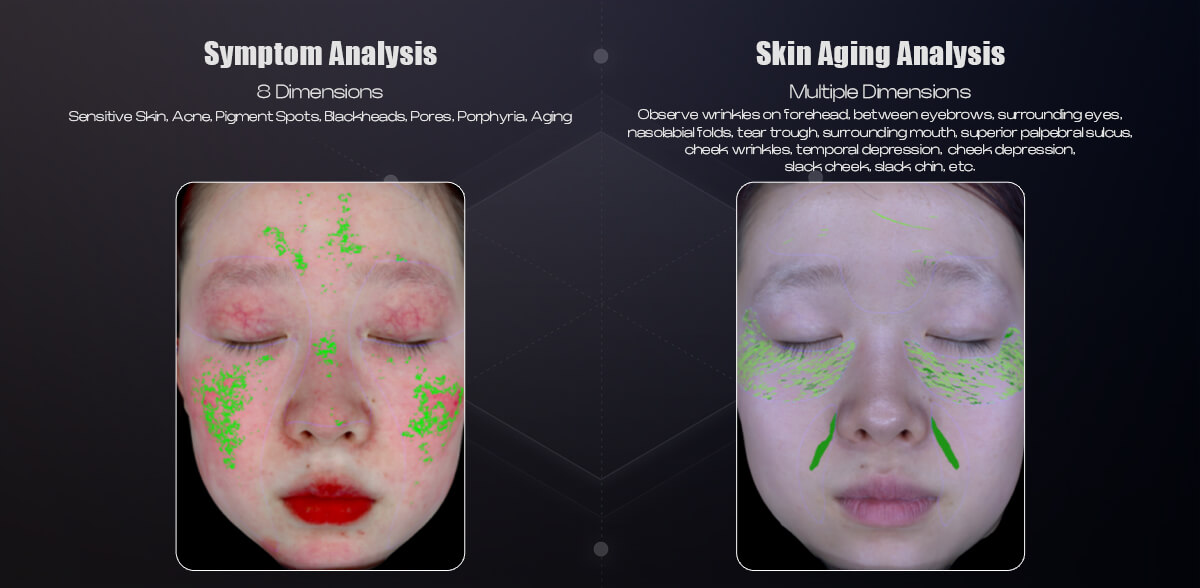 3D skin analysis machine (8).jpg