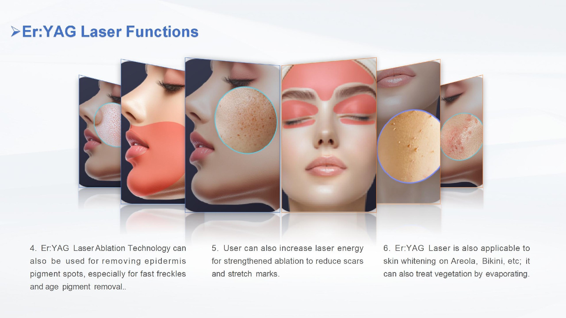 铒激光 Erbium laser Beijing Sanhe - 副本_04.jpg